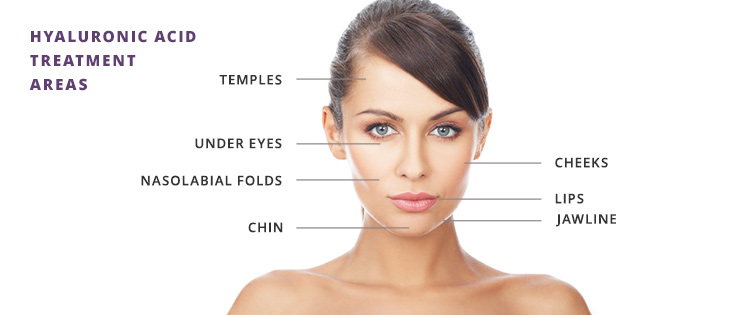 Advantages of Hyaluronic Acid nonsurgical injections